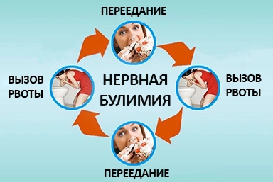 Лечение булимии в Завьялово